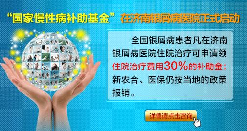 牛皮癣的诊断方法有那些