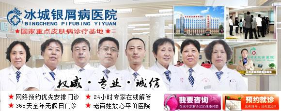 牛皮癣的治疗原则是什么呢