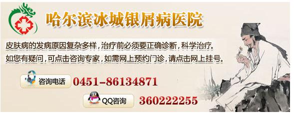 哈尔滨治皮肤病哪里更好?哈尔滨冰城银屑病医院