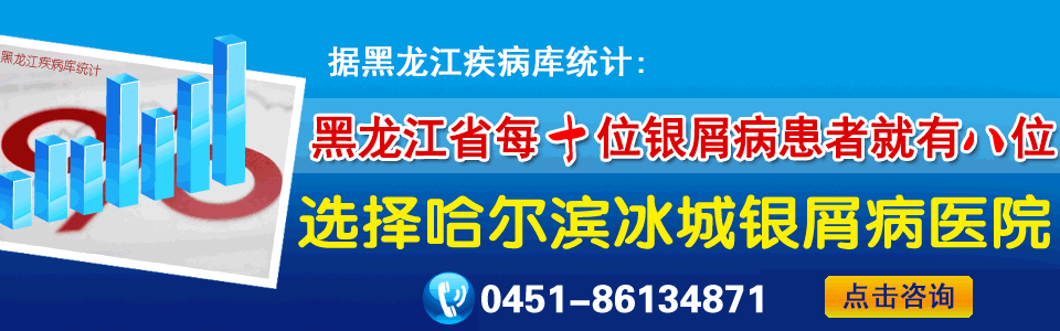 哈尔滨治皮肤病哪里更好?哈尔滨冰城银屑病医院