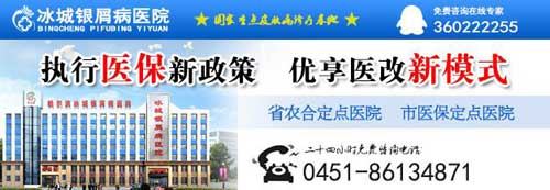 知道女人牛皮癣有哪些症状么