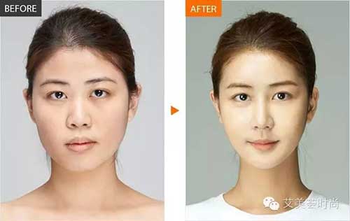 巴诺巴奇院长莅临深圳艾美荟洽谈合作