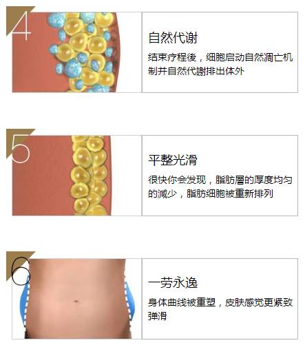 西安艺星医院——让您拥有纤纤细腿