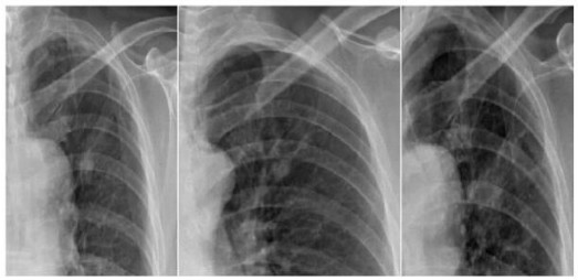 DR�۲죺û�п��ӻ���Ƭ���ΰ���ɸ�����˿���