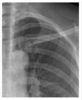 DR�۲죺û�п��ӻ���Ƭ���ΰ���ɸ�����˿���