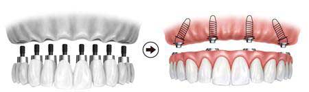 寻口福种口好牙享健康